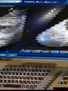 דלקת בפרוסטטה בכלבים לא מסורסים